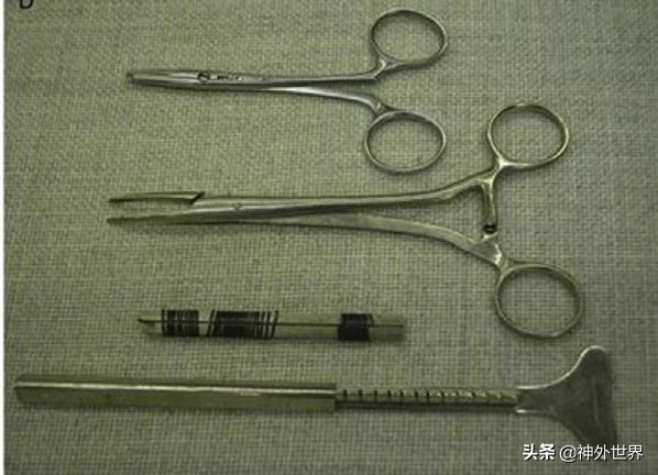 神经外科的止血方法,神经外科医学常识总结