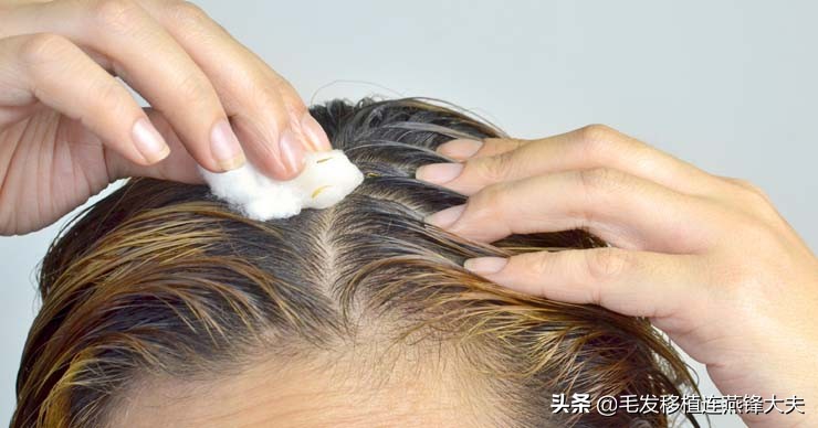 热水和冷水洗头哪个去油,热水洗头和冷水洗头哪个更蓬松