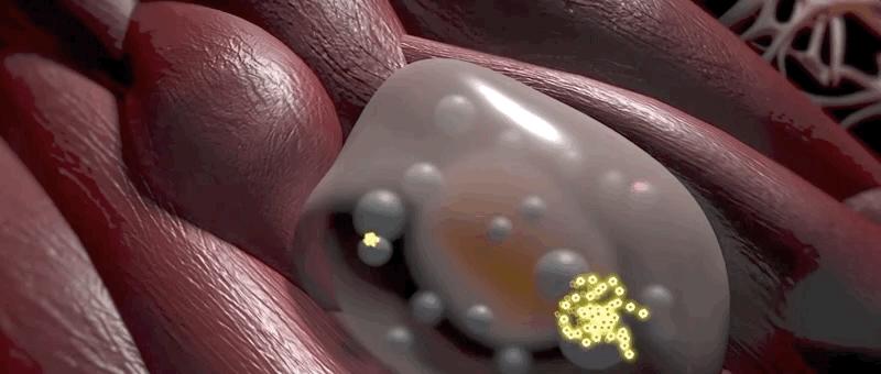 哮喘的发病原理,哮喘科普文章作品简介