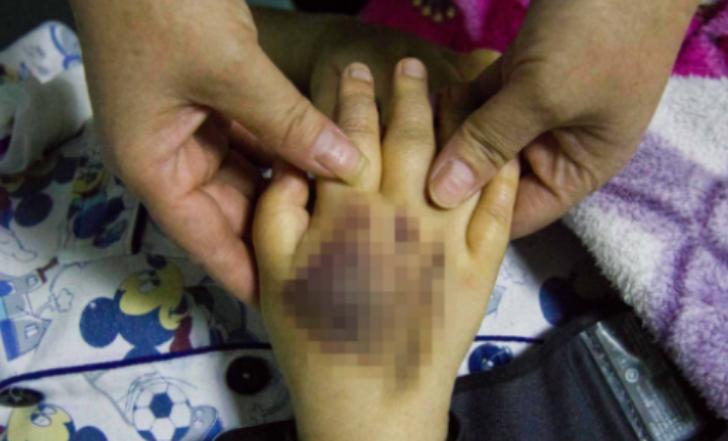 5岁男孩上吐下泻怎么回事,6岁男童上吐下泻是怎么回事