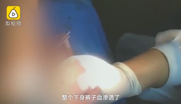 甘肃女孩被打身体出血,甘肃八岁女孩被打