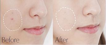 学生*党**也用得起的平价精华：相宜本草口碑好，禾宝很多人没听过