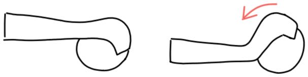 用久了鼠标手腕疼怎么办,鼠标手手腕酸痛