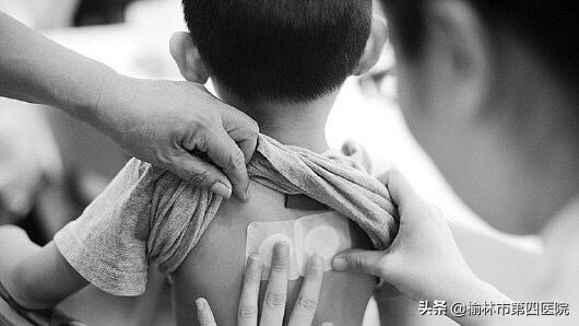 榆林市星元医院“冬病夏治”贴敷治疗项目正式启动