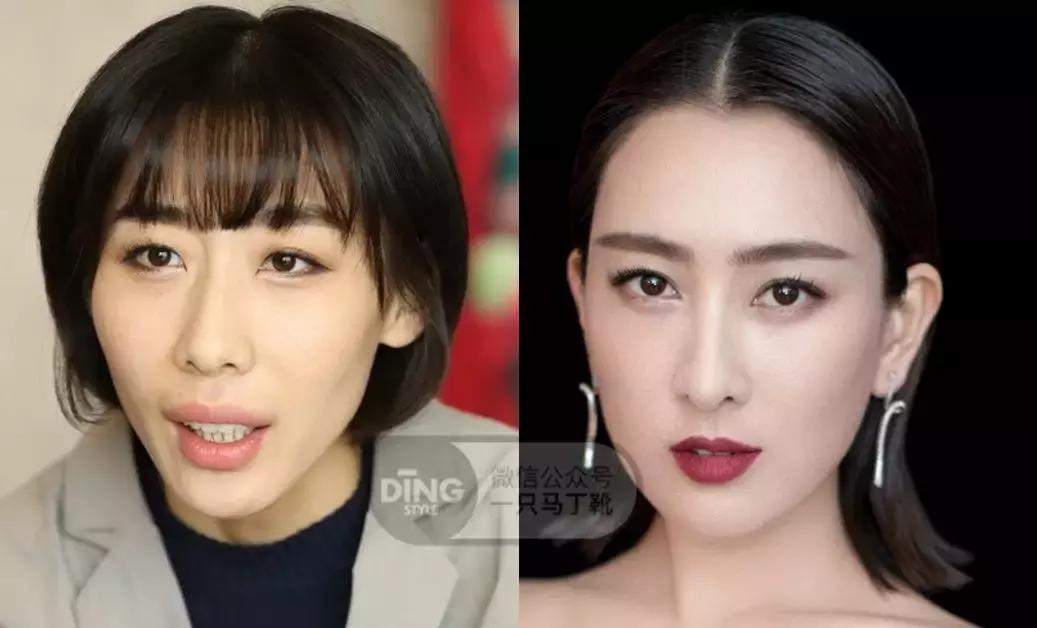 中庭又长又宽显老,中庭长怎么避免显老