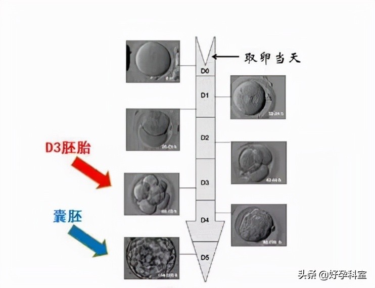 试管怎么提升妊娠率,试管婴儿怎样提高受孕成功率