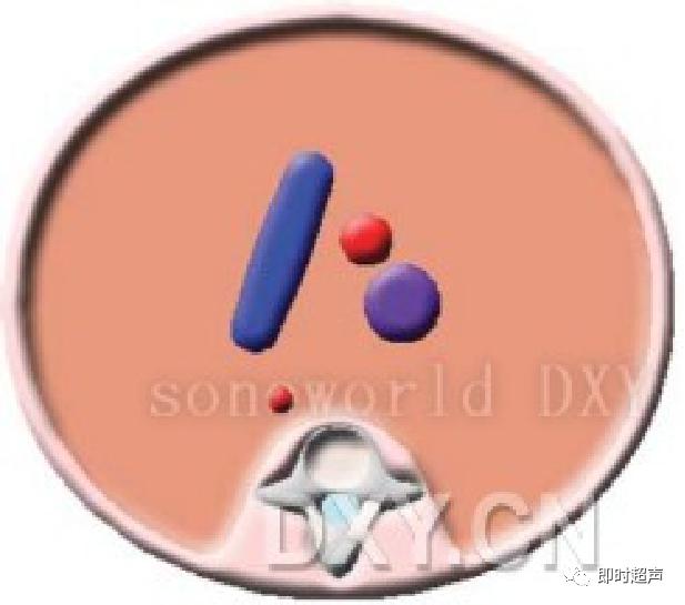 胎儿心脏三种血管关系模式图,25周的胎儿心脏弓切面多少正常