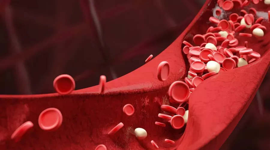 弗林斯综合症，影响身体许多部位发育的疾病，患者多有隔膜缺陷