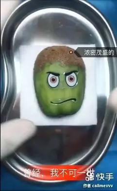 香蕉割包皮,洋葱剖腹产?这是我见过最秀的医生