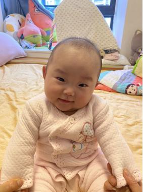 四月龄宝宝习惯性斜颈怎么纠正,儿童习惯性斜颈矫正手法视频