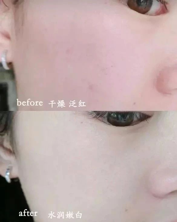 倪妮的肌肤怎么变好看,倪妮护肤