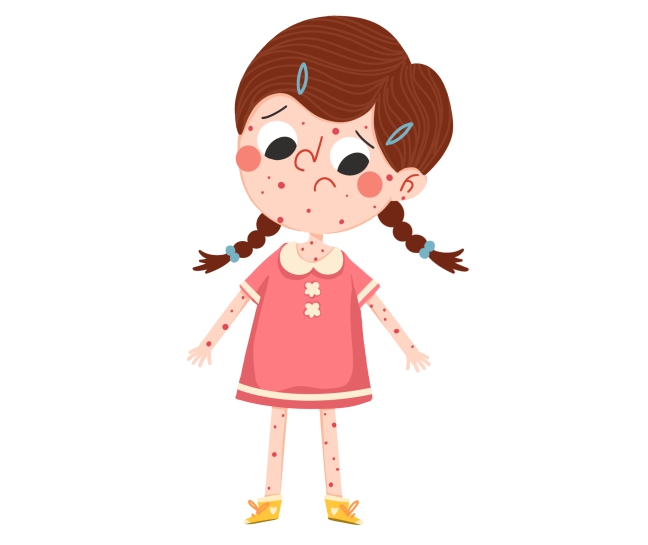 湿疹的饮食注意,儿童饮食建议及注意事项