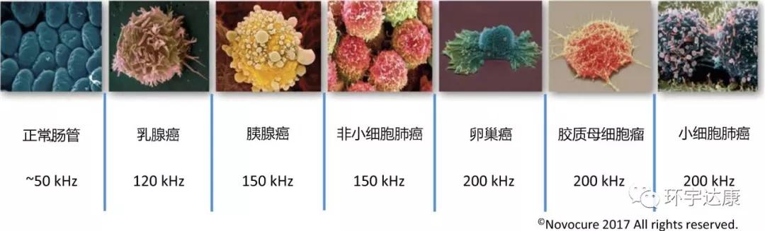 癌细胞电场疗法,内置电场杀死癌症细胞
