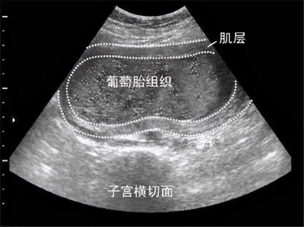 吃葡萄生男孩吗,吃葡萄会生出来什么样的孩子