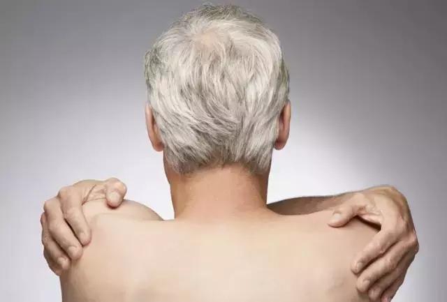 男人白头发多是肾虚吗,肾虚导致白头发怎么补