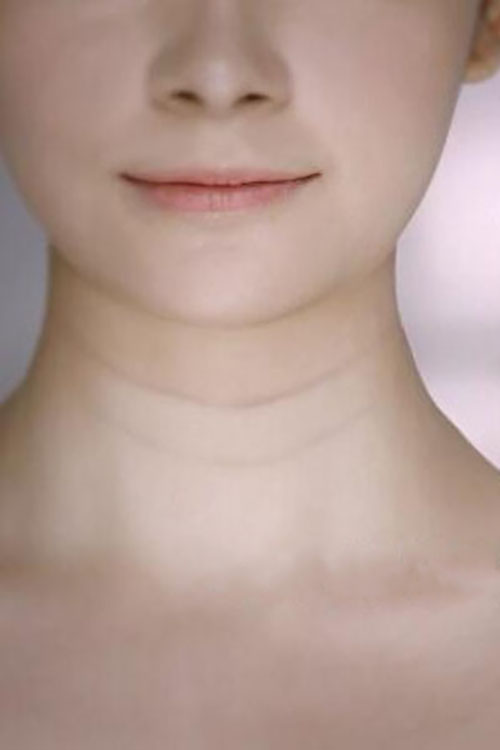 出现颈纹怎么办如何有效消除颈纹,颈纹怎么消除简单方法淡化颈纹