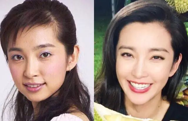 哪些明星整牙后像整容,明星整牙变美了