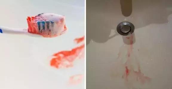 一口黄牙能洗白吗,一口黄牙毁了一张脸