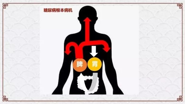 肿瘤与糖尿病的区别,糖尿病与癌症之间回顾性分析