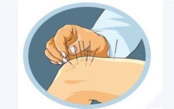 老百姓能看懂的膝关节炎治疗指南