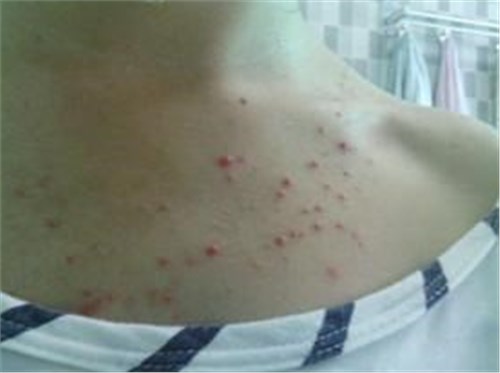 女生没事的时候多低头看看这个地方，越大越要引起重视