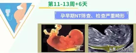 避孕套挤进宅家热销榜前十!怀孕这件事,请做好这2个准备