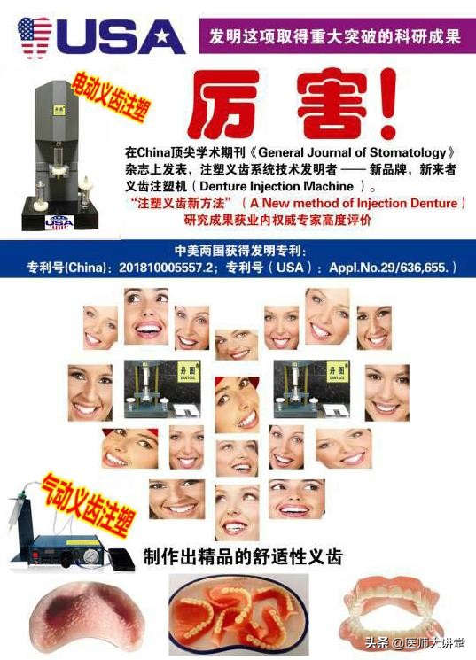 活动假牙排牙制作,下牙义齿制作