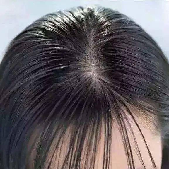 叹头部SPA!拒做人间“油”物,解锁防秃养发小妙招