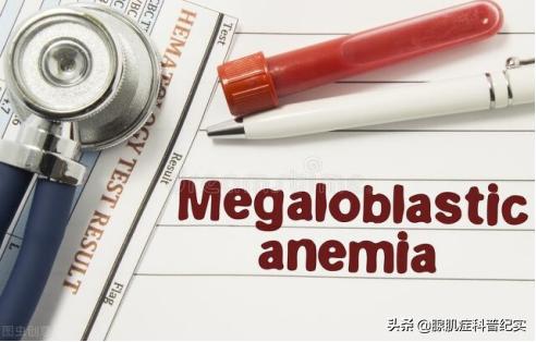 贫血严重怎么办,严重贫血该吃什么补