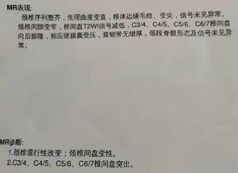 60岁老人左臂被砸断,老太太被肘击