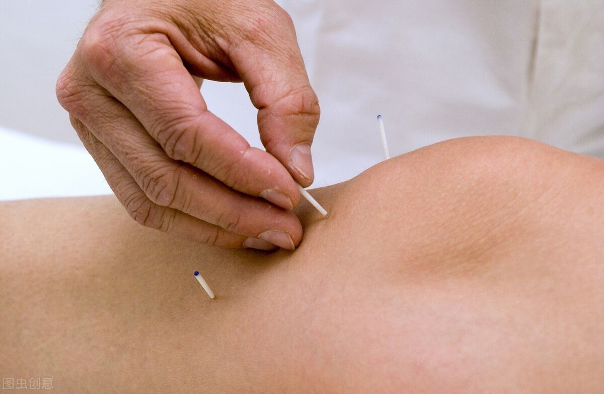 肘关节痛风针灸解决最好办法,痛风脚踝疼针灸哪个穴位