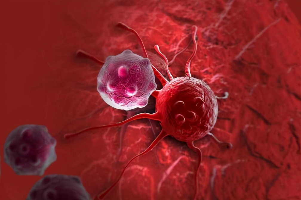 癌症复发后转移,还能救吗?医生直言:4个方法或能救上一命