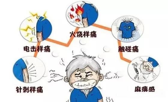 带状疱疹引起脖子有一条筋很痛,带状疱疹患者神经痛视频