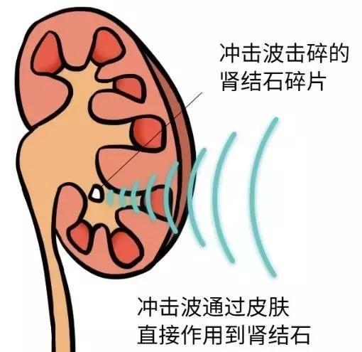 泌尿外科都是男的吗,泌尿外科都是些什么病人