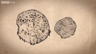 身体细胞死亡后怎么处理,人体怎么清除衰老细胞