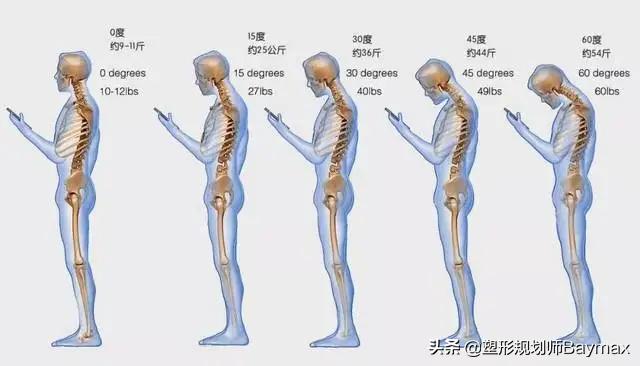 为什么背有富贵包,背很厚有富贵包怎么解决