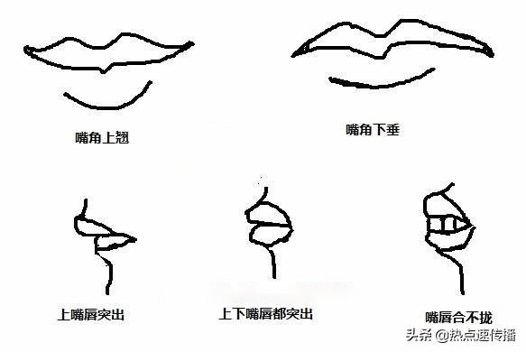 导致下巴歪的原因有哪些,下巴后缩严重的案例