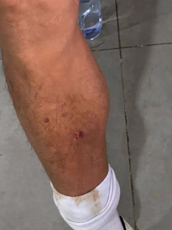 大将之风！广州传奇被飞铲，赛后回应：为了比赛，对方不是故意的