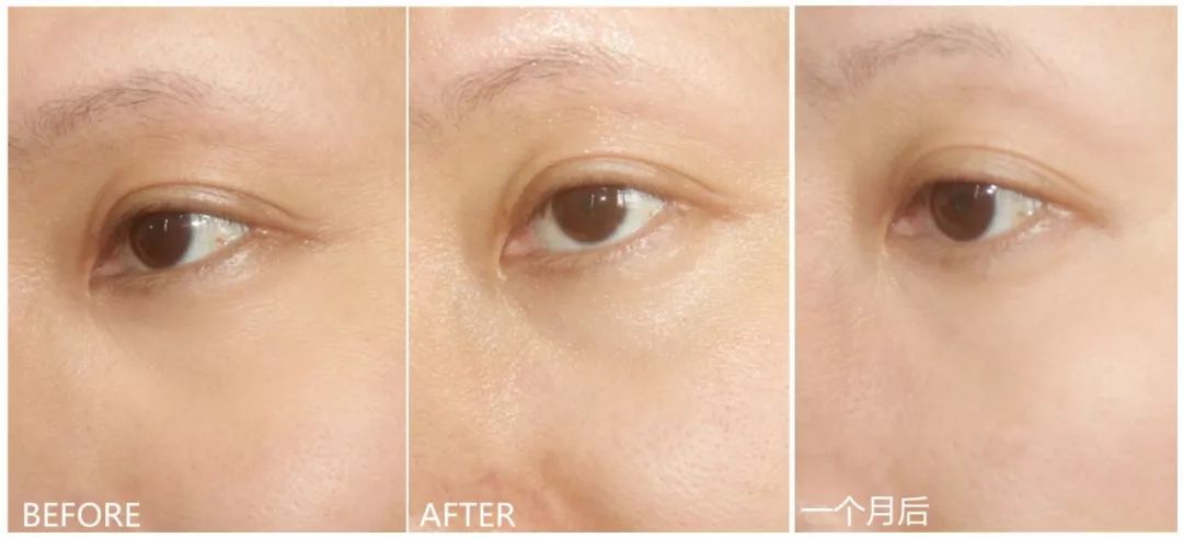 兰蔻明星大红瓶,明星同款兰蔻口红