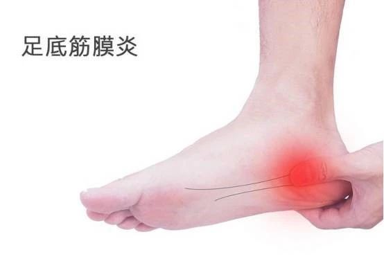 体能康复|跳绳中容易出现哪些问题呢?