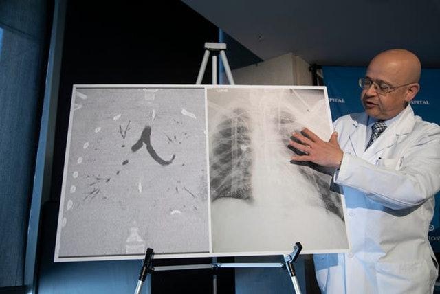 *子烟电**起源于中国，流行于欧美，商机巨大，但对人的危害超乎想象