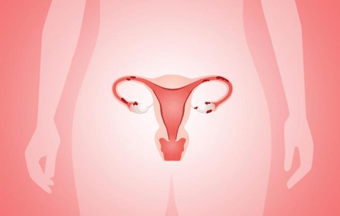 女子上了节育环会腰疼吗,女人上节育环会变胖吗