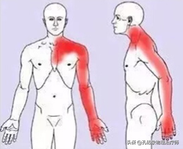 常手麻需警惕,常觉得手麻