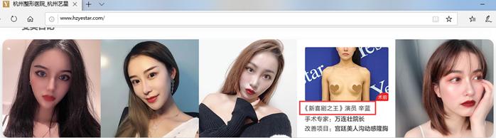 艺星医疗美容是莆田系吗,艺星美容莆田