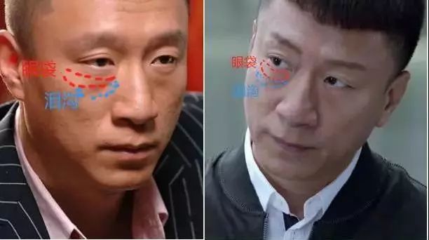 罗志祥的眼袋图片,罗志祥卧蚕眼真实照片