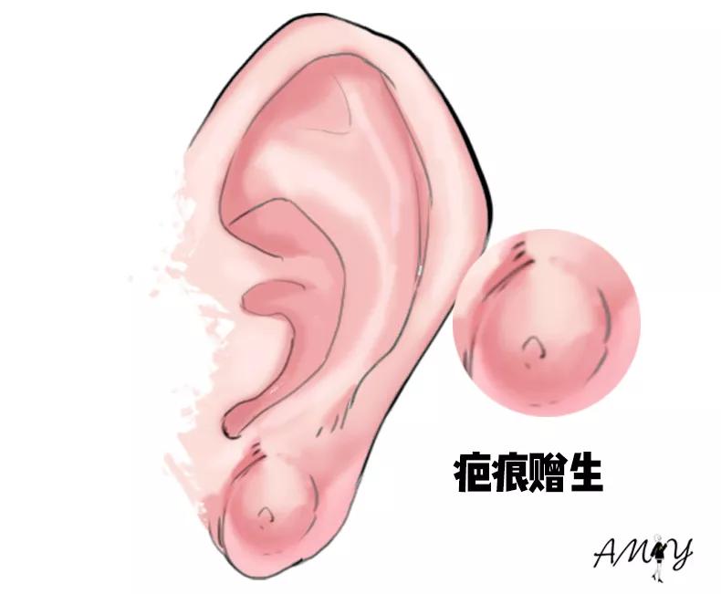 这六种人不能打耳洞,千万别随便打耳洞