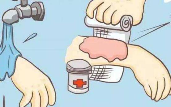 小孩子开水烫伤掉皮多久不会疼痛,手被炉子烫伤怎么快速减少疼痛