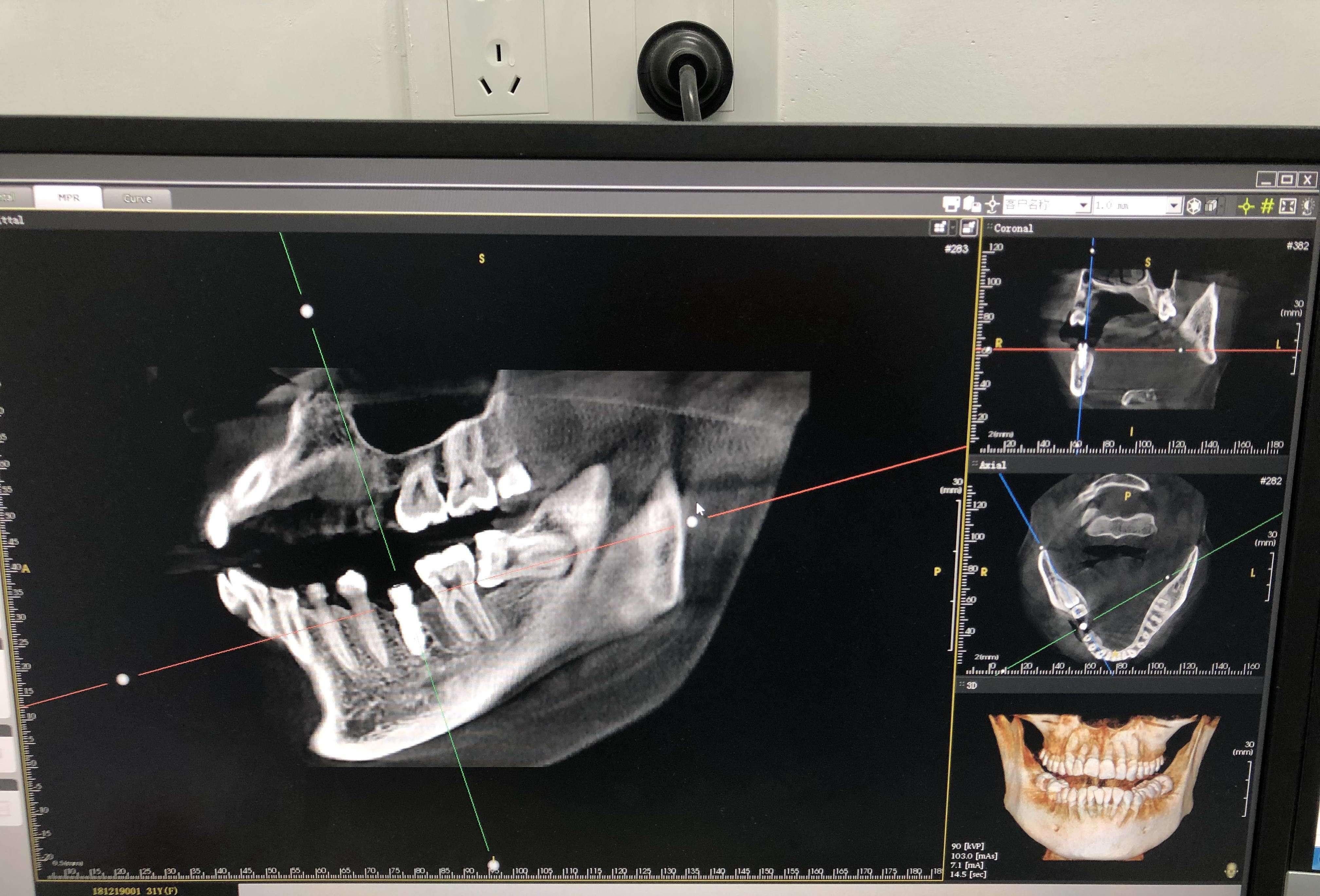 上海科瓦口腔直播,科瓦口腔