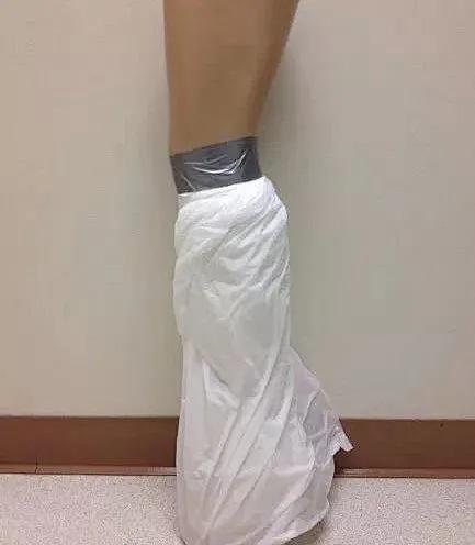 骨科大夫带您了解：神奇的“石膏”