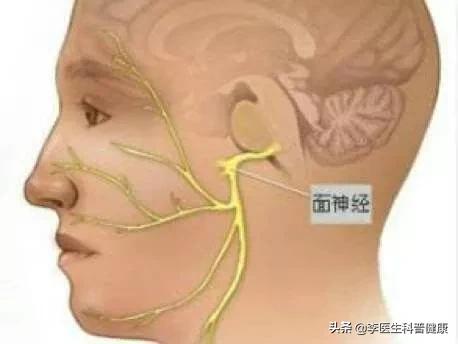 面部吹点冷风，发现眼睛闭不上了，嘴巴也歪了，到底是咋回事儿？